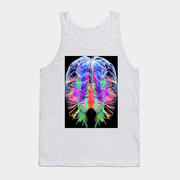 White matter fibres and brain, artwork (C015/1936) Tank Top by SciencePhoto